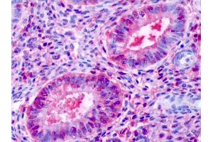 Anti-ESRRB / ERR-Beta antibody IHC of human uterus, endometrial glands. (ESRRB anticorps  (N-Term))