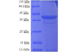 Cytochrome B5 Type A (Microsomal) (CYB5A) (AA 2-97), (partial) protein (GST tag)