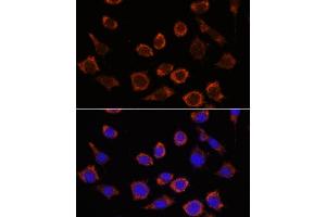 Immunofluorescence analysis of L929 cells using RPL35 antibody (ABIN7270004) at dilution of 1:100. (RPL35 anticorps  (AA 50-120))