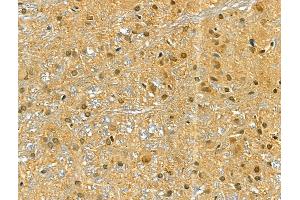 ABIN6266097 and ABIN6268826 at 1/100 staining Rat brain tissue by IHC-P. (ZEB2 anticorps  (N-Term))