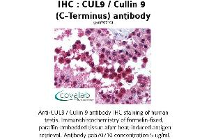 Image no. 1 for anti-Cullin 9 (CUL9) antibody (ABIN1733383)