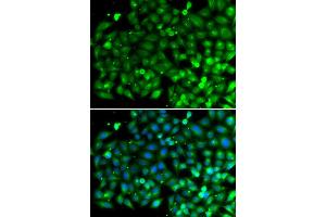 Immunofluorescence analysis of A549 cell using SH3GLB1 antibody. (SH3GLB1 anticorps)