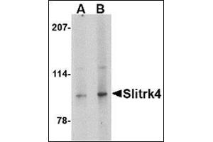 Western blot analysis of Slitrk4 in mouse brain tissue lysate with this product at (A) 0. (SLITRK4 anticorps  (C-Term))