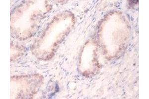 Immunohistochemistry of paraffin-embedded human prostate tissue using ABIN7174131 at dilution of 1:100 (SNRPA1 anticorps  (AA 8-278))