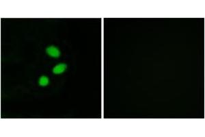 Immunofluorescence analysis of MCF7 cells, using TSH2 Antibody. (THNSL2 anticorps  (AA 811-860))