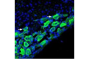Expression of nAChRα9 in rat DRGImmunohistochemical staining of rat dorsal root ganglion (DRG) frozen sections using Anti-Nicotinic Acetylcholine Receptor α9 (CHRNA9) Antibody (ABIN7581858), (1:400), followed by goat-anti-rabbit-AlexaFluor-488.