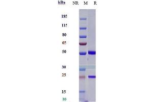 Anti-CD47 Reference Antibody (lemzoparlimab) on SDS-PAGE under reducing (R) condition. (Recombinant CD47 (Lemzoparlimab Biosimilar) anticorps)