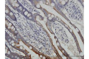 Immunoperoxidase of monoclonal antibody to DLD on formalin-fixed paraffin-embedded human small Intestine. (DLD anticorps  (AA 1-509))