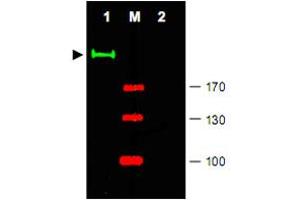 Western blot using Gli2 polyclonal antibody  shows detection of a predominant band at ~190 KDa corresponding to Gli2 (arrowhead) in mouse brain tissue lysate (Lane 1). (GLI2 anticorps  (Internal Region))