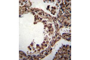 TUBA1C Antibody (C-term) (ABIN655982 and ABIN2845366) immunohistochemistry analysis in formalin fixed and paraffin embedded human lung tissue followed by peroxidase conjugation of the secondary antibody and DAB staining. (TUBA1C anticorps  (C-Term))