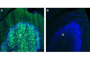 Expression of GABA(A) β3 in mouse cerebellum.