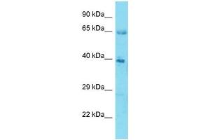 Host:  Rabbit  Target Name:  KLHL12  Sample Type:  Stomach Tumor lysates  Antibody Dilution:  1. (KLHL12 anticorps  (N-Term))