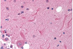 Human Brain, Cerebellum (formalin-fixed, paraffin-embedded) stained with SOX11 antibody ABIN214147 at 5 ug/ml followed by biotinylated goat anti-rabbit IgG secondary antibody ABIN481713, alkaline phosphatase-streptavidin and chromogen.