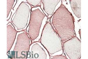 ABIN571257 (3. (TRIM72 anticorps  (Internal Region))