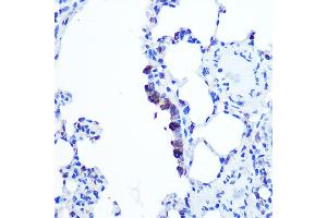 Immunohistochemistry of paraffin-embedded Rat lung using TOP1MT Rabbit pAb (ABIN7270851) at dilution of 1:100 (40x lens). (TOP1MT anticorps  (AA 470-550))