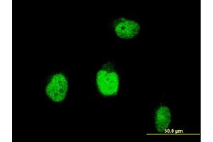 Immunofluorescence of monoclonal antibody to BLM on HeLa cell. (BLM anticorps  (AA 1196-1295))