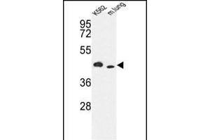 Western blot analysis of hITPKA- (ABIN392800 and ABIN2842236) in K562 cell line and mouse lung tissue lysates (35 μg/lane).