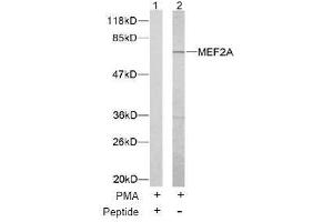 Image no. 1 for anti-Myocyte Enhancer Factor 2A (MEF2A) (Thr312) antibody (ABIN197165) (MEF2A anticorps  (Thr312))