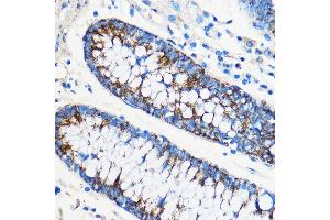 Immunohistochemistry of paraffin-embedded Human colon using  antibody (ABIN3020671, ABIN3020672, ABIN1512605 and ABIN6213659) at dilution of 1:50 (40x lens).