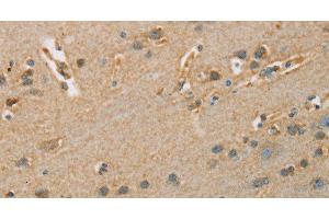 Immunohistochemistry of paraffin-embedded Human brain tissue using ARSA Polyclonal Antibody at dilution 1:50 (Arylsulfatase A anticorps)