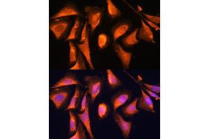 Immunofluorescence analysis of U-2 OS cells using R antibody (ABIN6128592, ABIN6146556, ABIN6146557 and ABIN6215667) at dilution of 1:100.