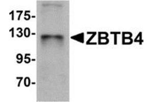 Western blot analysis of ZBTB4 in SK-N-SH cell lysate with ZBTB4 antibody at 1 μg/ml. (ZBTB4 anticorps  (C-Term))