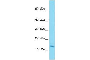 Host: Rabbit Target Name: C6orf1 Sample Type: Fetal Lung lysates Antibody Dilution: 1. (C6ORF1 anticorps  (N-Term))