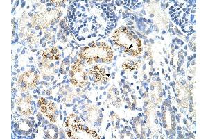 CDC25B antibody was used for immunohistochemistry at a concentration of 4-8 ug/ml to stain Epithelial cells of renal tubule (arrows) in Human Kidney. (CDC25B anticorps)