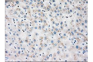 Immunohistochemical staining of paraffin-embedded liver tissue using anti-PLK1mouse monoclonal antibody. (PLK1 anticorps)