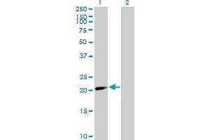 Western Blot analysis of BATF2 expression in transfected 293T cell line by BATF2 MaxPab polyclonal antibody. (BATF2 anticorps  (AA 1-189))