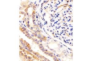 Antibody staining USP2 in human kidney tissue sections by Immunohistochemistry (IHC-P - paraformaldehyde-fixed, paraffin-embedded sections). (USP2 anticorps  (C-Term))