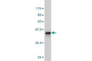 Western Blot detection against Immunogen (36. (DAZ1 anticorps  (AA 21-120))