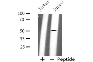 Western blot analysis of extracts from Jurkat cells, using PLD4 antibody. (Phospholipase D4 anticorps  (C-Term))