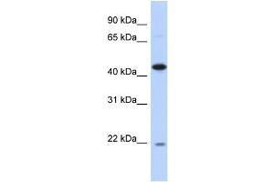WB Suggested Anti-NOB1 Antibody Titration: 0. (NOB1 anticorps  (N-Term))