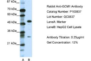 WB Suggested Anti-GCM1  Antibody Titration: 0. (GCM1 anticorps  (C-Term))