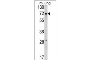 Western blot analysis of FMR1 Antibody (N-term) (ABIN390866 and ABIN2841083) in mouse lung tissue lysates (35 μg/lane). (FMR1 anticorps  (N-Term))