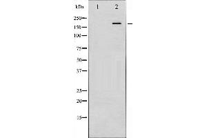 Western Blotting (WB) image for anti-Insulin Receptor Substrate 1 (IRS1) (pSer307) antibody (ABIN1844090) (IRS1 anticorps  (pSer307))