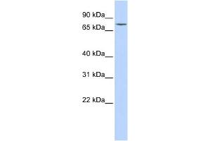 WB Suggested Anti-GALC Antibody Titration:  0. (GALC anticorps  (Middle Region))