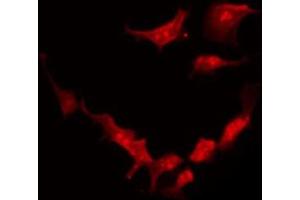 ABIN6273921 staining HeLa by IF/ICC. (FZD2 anticorps  (Internal Region))