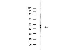 anti-DNA (Cytosine-5-)-Methyltransferase 3 Like (TRDMT1) (Internal Region) antibody