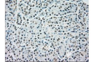 Immunohistochemical staining of paraffin-embedded colon tissue using anti-BRAFmouse monoclonal antibody. (BRAF anticorps)