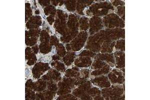 Immunohistochemical staining of human stomach with ABHD2 polyclonal antibody  shows strong cytoplasmic positivity in glandular cells at 1:10-1:20 dilution. (ABHD2 anticorps)