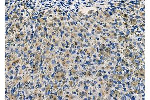 ABIN6264633 and ABIN6277558 at 1/100 staining Rat ovarian tissue by IHC-P. (RANGAP1 anticorps  (N-Term))