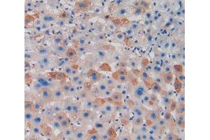 IHC-P analysis of liver tissue, with DAB staining. (PAD4 anticorps  (AA 1-300))
