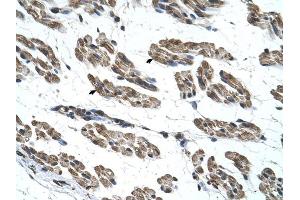 RNF40 antibody was used for immunohistochemistry at a concentration of 4-8 ug/ml to stain Skeletal muscle cells (arrows) in Human Muscle.