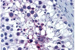 anti-Endoplasmic Reticulum Protein 44 (ERP44) (AA 30-407) antibody