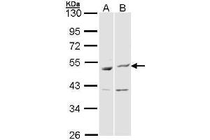 WB Image Sample (30 ug of whole cell lysate) A: Hela B: Molt-4 , 10% SDS PAGE antibody diluted at 1:1000 (BAG5 anticorps)