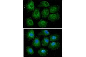 Immunofluorescent staining of Hep3B cell line with antibody.