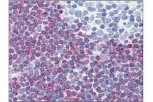 Immunohistochemistry (IHC) image for anti-Programmed Cell Death 4 (PDCD4) (AA 1-469), (N-Term) antibody (ABIN317548) (PDCD4 anticorps  (N-Term))