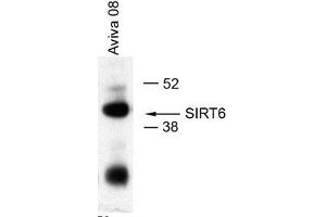 IP: 5 ul in 1ml of U2OS lysates (SIRT6 anticorps  (Middle Region))